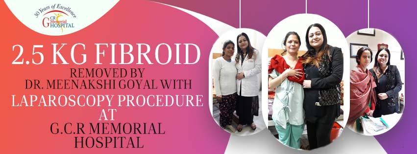 2.5 Kg Fibroid With Through Laparoscopy Procedure at G.C.R Memorial Hospital (2)